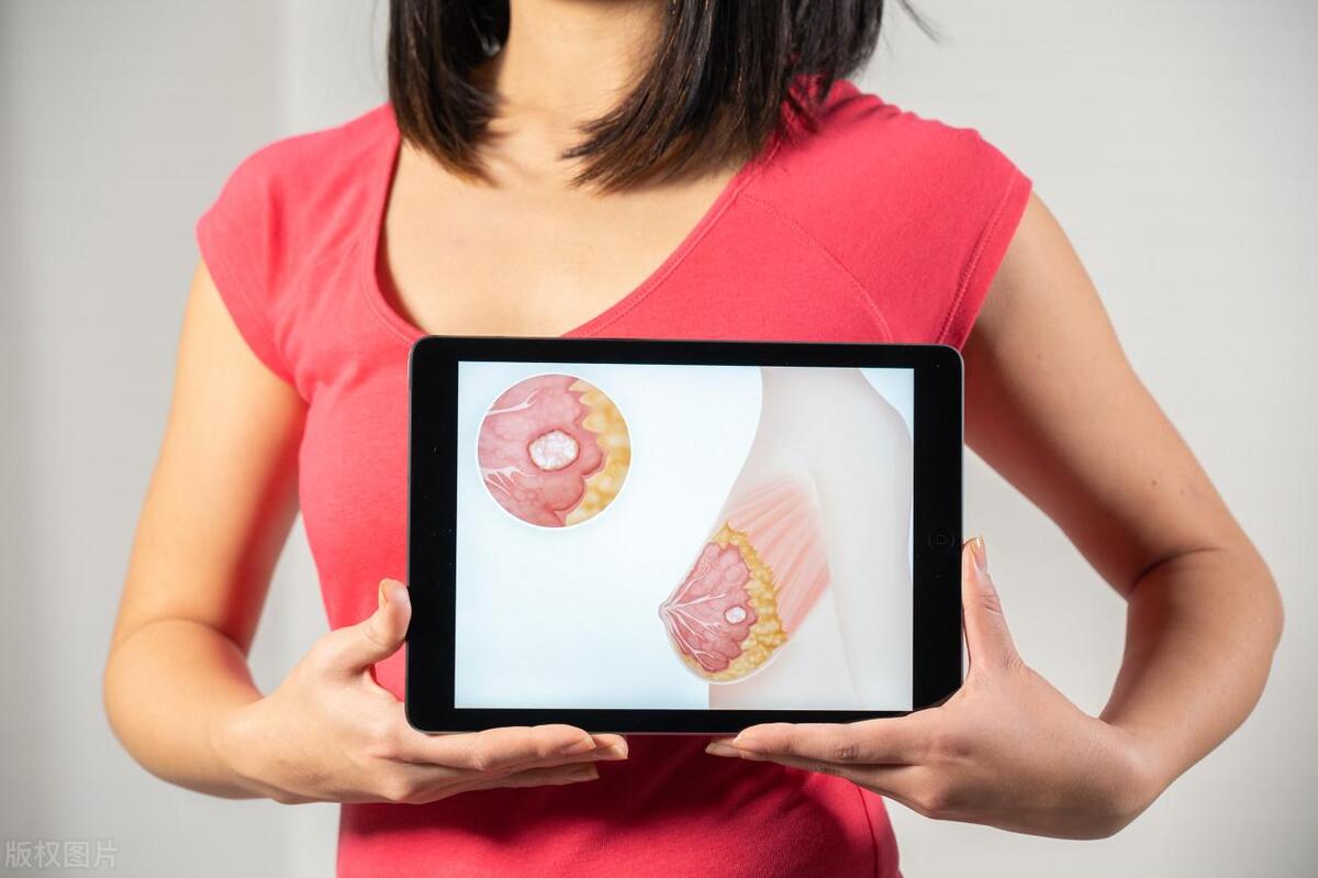 乳腺癌早期症状图片 乳腺癌的诊断方法